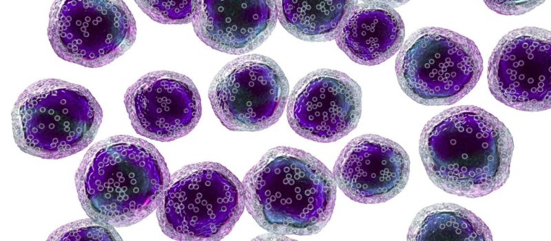 Diffüz Büyük B-Hücreli Lenfoma