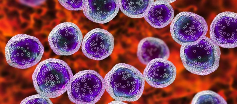 Foliküler Lenfoma - Nedir, Belirtileri ve Tedavisi