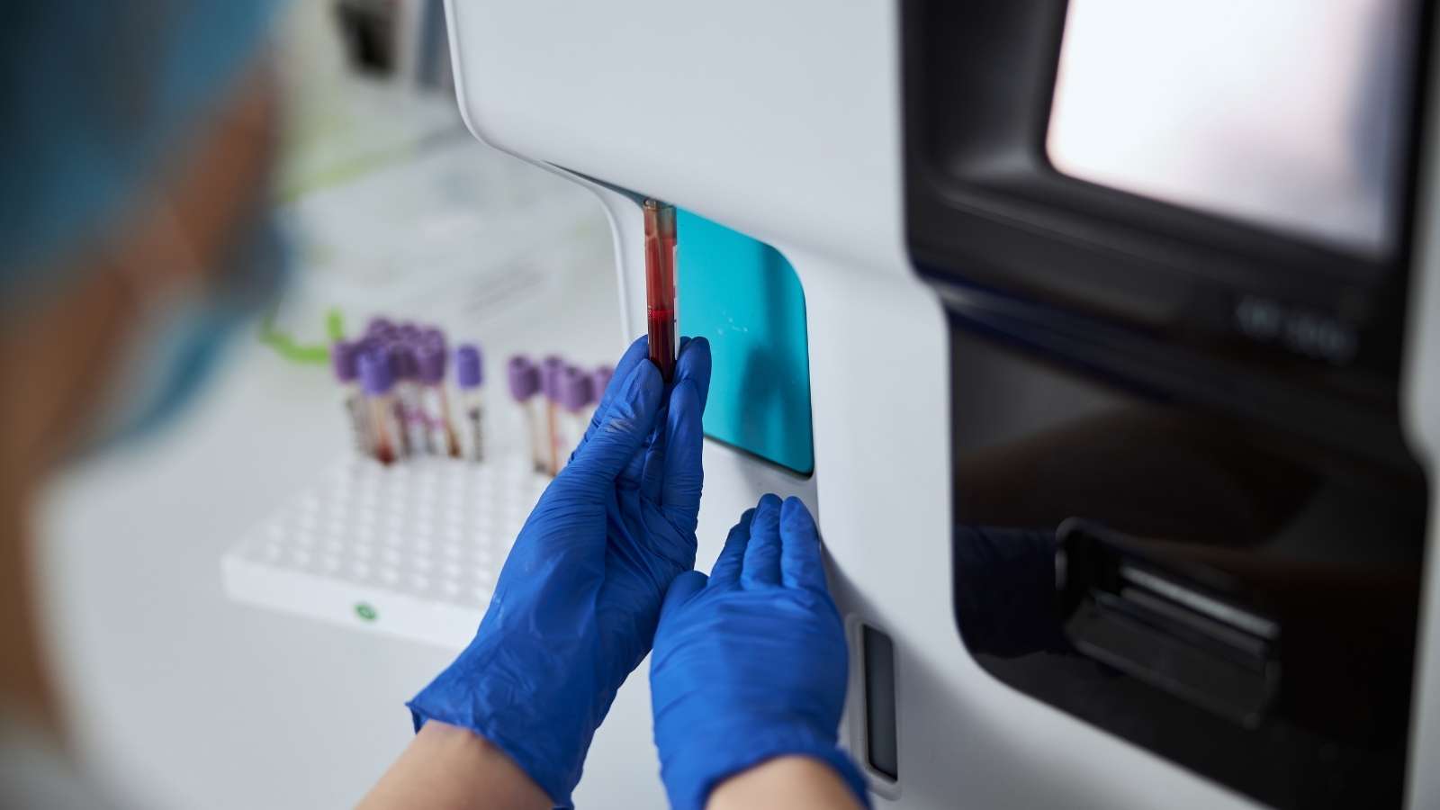 Hematoloji Hastalıkları Nelerdir? Hematoloji Hastalıkları Nelerdir?